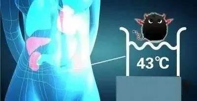 腫瘤熱療加熱技術的進展
